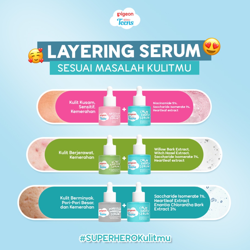 Serum Remaja Pigeon Teens Calm Fairy 20ml untuk Kulit Kemerahan dan Iritasi Foto 4