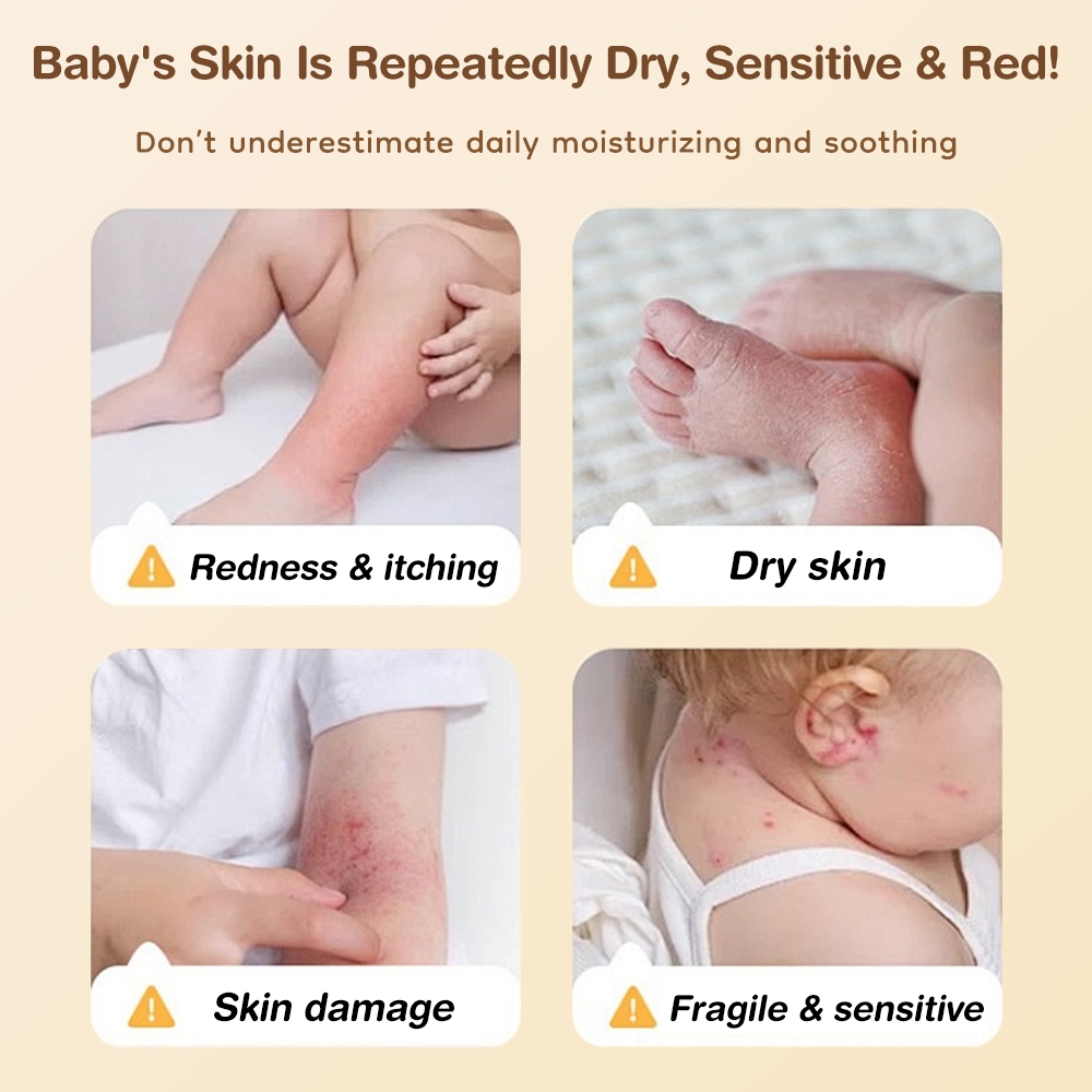 AVINIE All Purpose Baby Balm 30gr Bisabolol & Minyak Alpukat Untuk Ruam Popok Eksim Foto 2